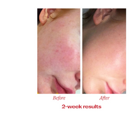Thumbnail for Vitamin C Booster Treatment