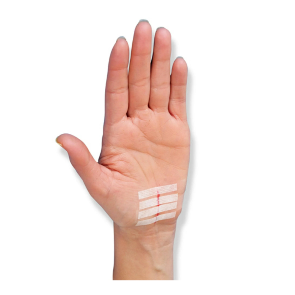 Nexcare Steri-Strip Skin Closure, Hypoallergenic