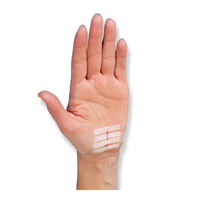 Thumbnail for Nexcare Steri-Strip Skin Closure, Hypoallergenic
