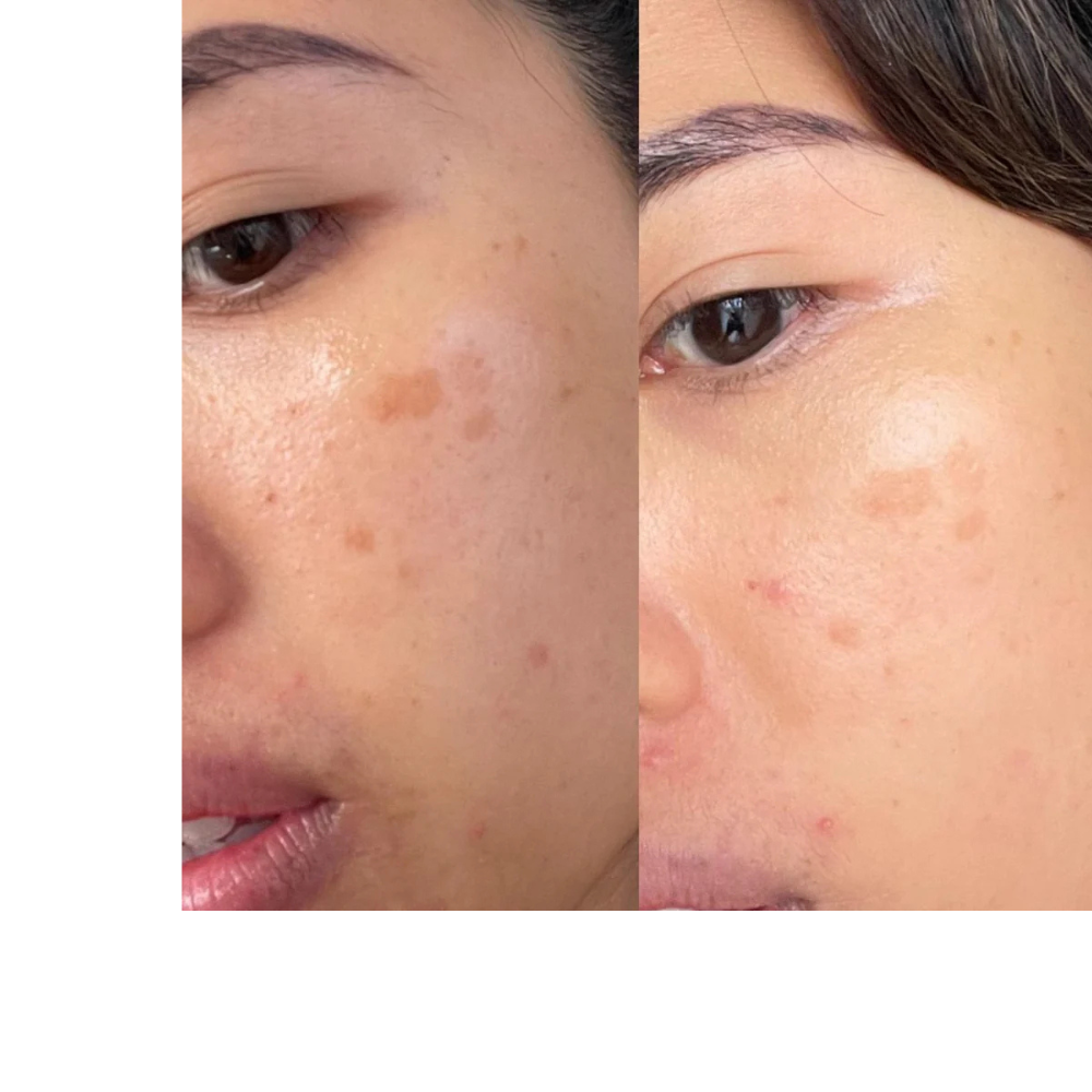 Vitamin C Booster Treatment