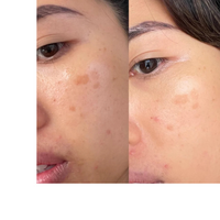 Thumbnail for Vitamin C Booster Treatment