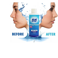 Thumbnail for Benzoyl Peroxide - 10%