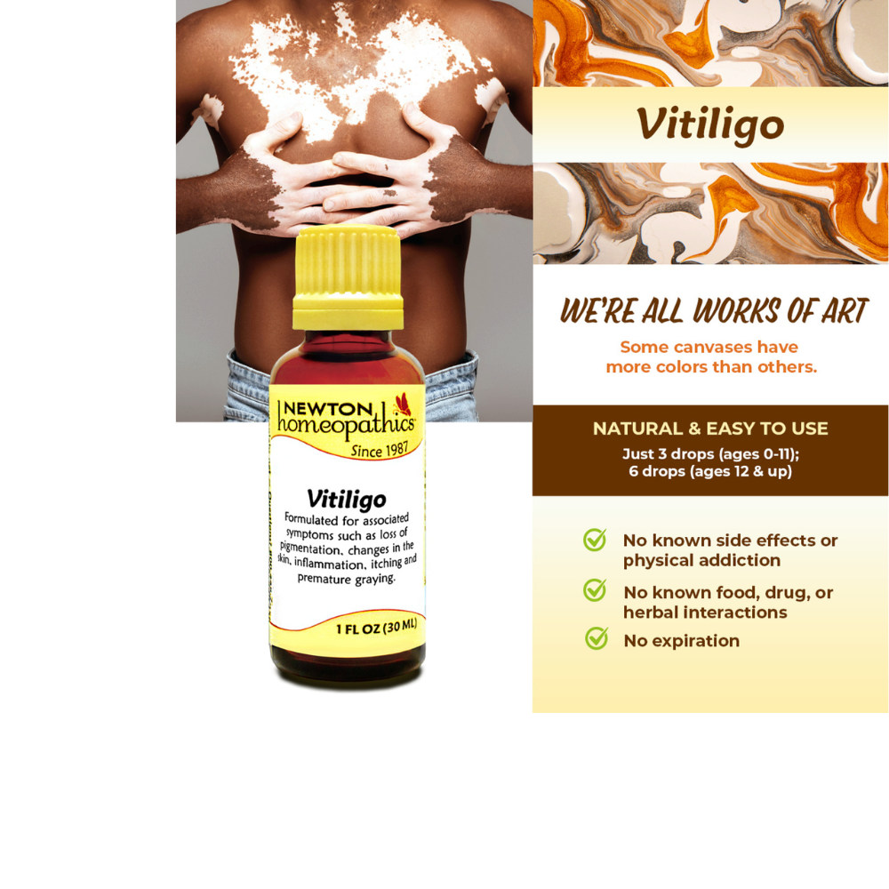 Newton Labs Vitiligo