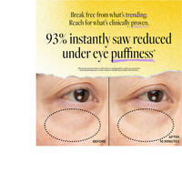 Thumbnail for Vitamin C Bright Eyes Hydro Gel Patches (5 pack)