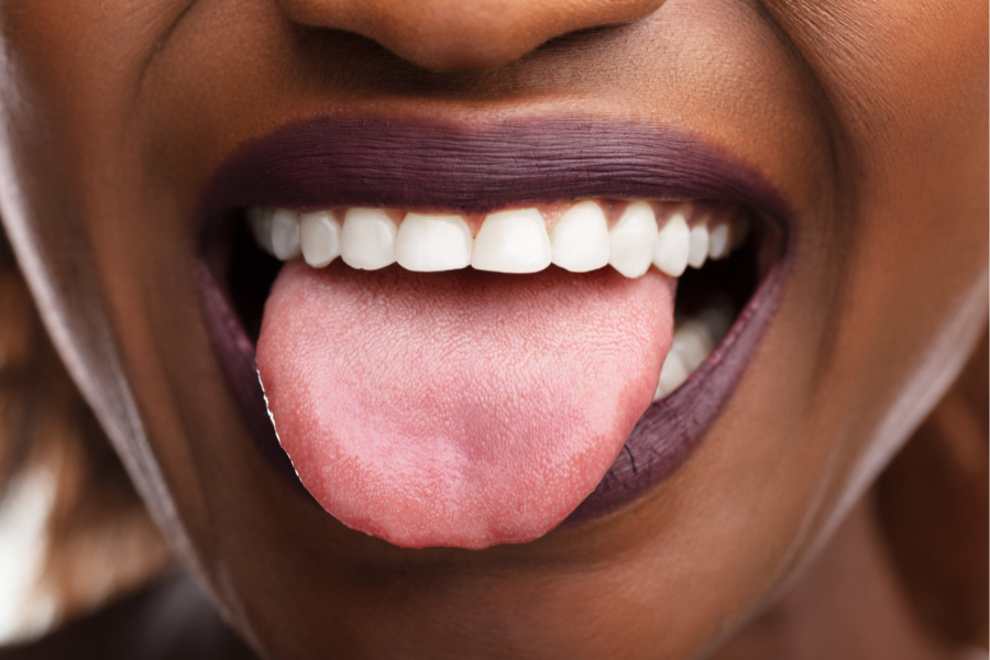 What a Healthy Tongue Should Look Like and Why You Should Clean It