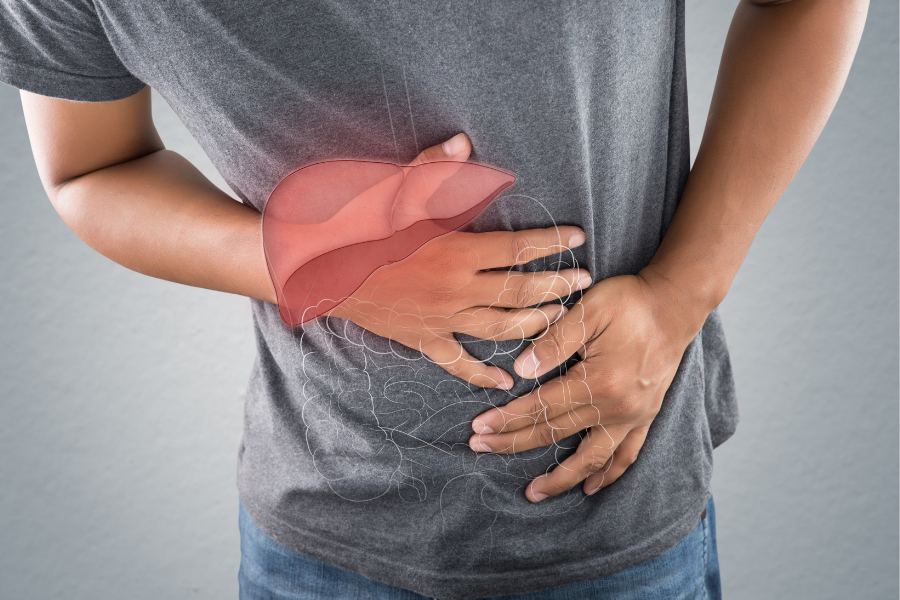 What is a Fatty Liver? Causes, Prevention and Natural Support
