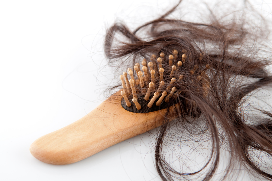 Natural Solutions for Alopecia