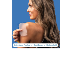Thumbnail for EZAcne Pimple Patches – Body