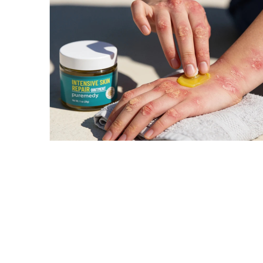 Intensive Skin Repair Ointment