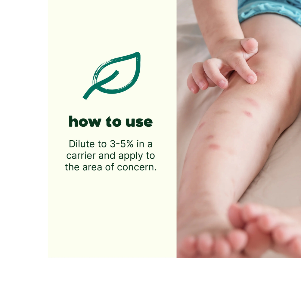 ITCH AWAY ESSENTIAL OIL
