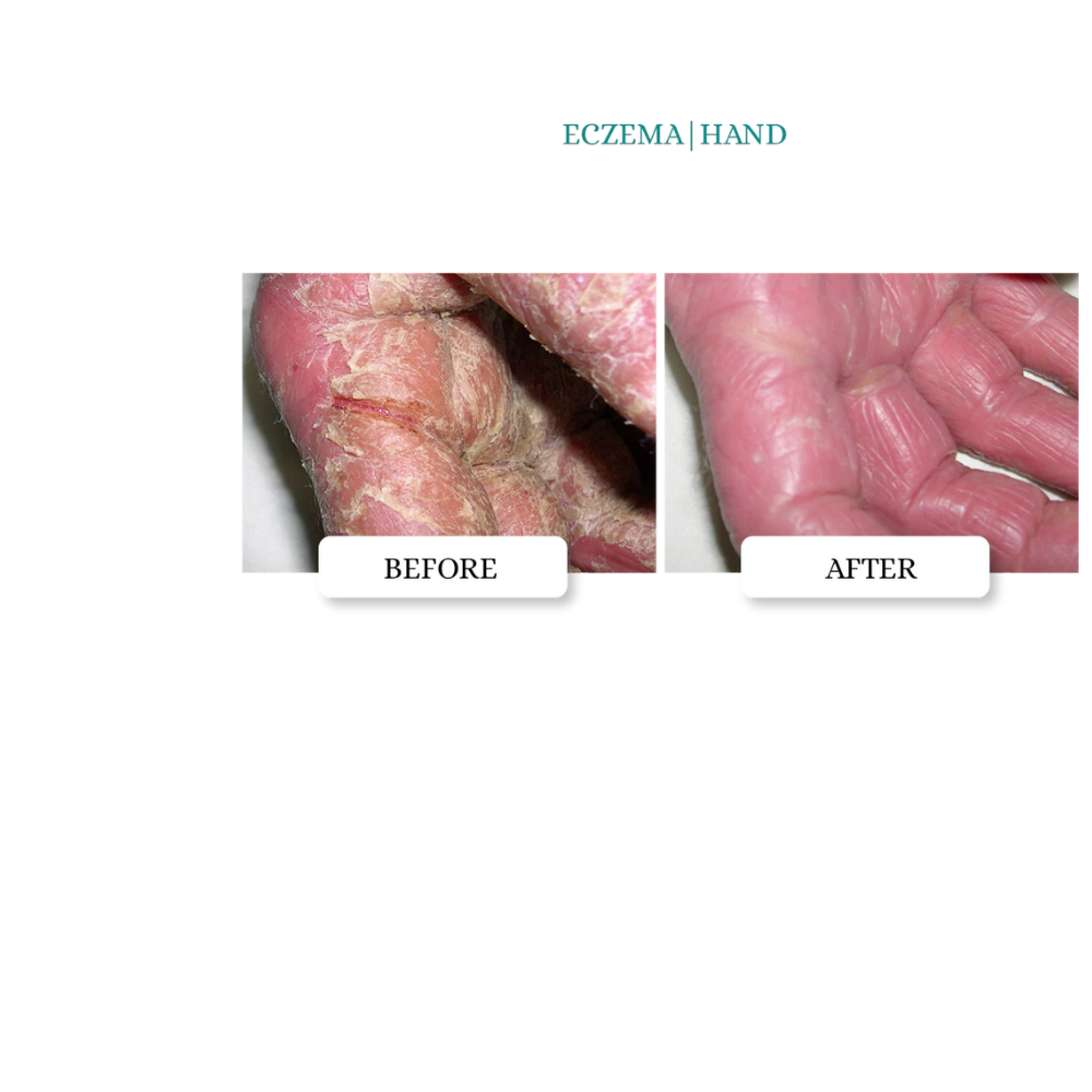 INTENSIVE SKIN REPAIR  OINTMENT