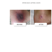 Thumbnail for SKIN TAG RELIEF OINTMENT