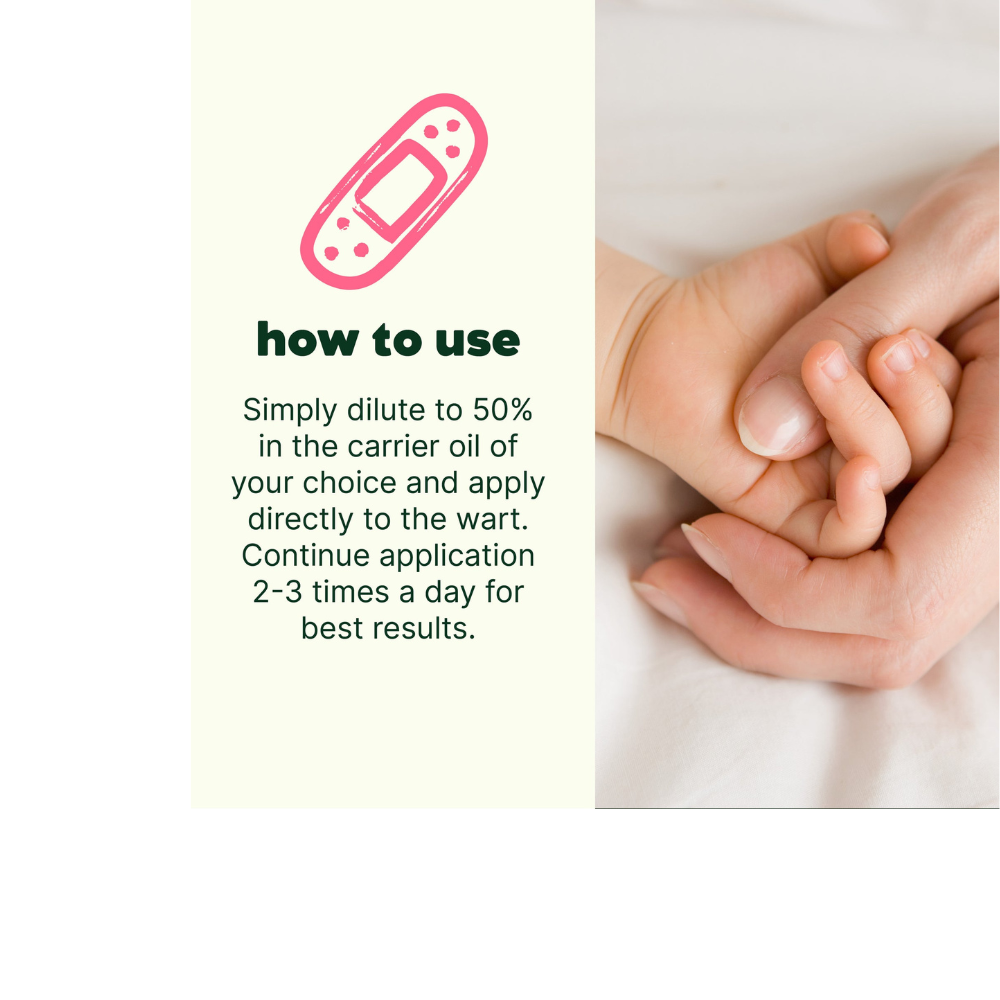 No More Warts Essential Oil Pre-Diluted Roll-On