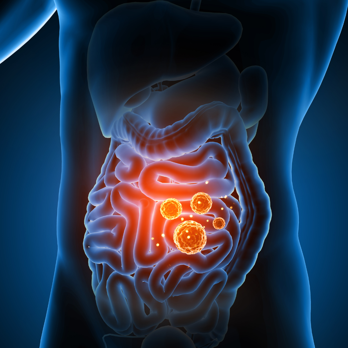 GI-MAP - Gut Health Panel